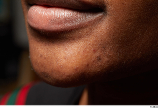 HD Face Skin Esdee Bullock chin face lips mouth skin…